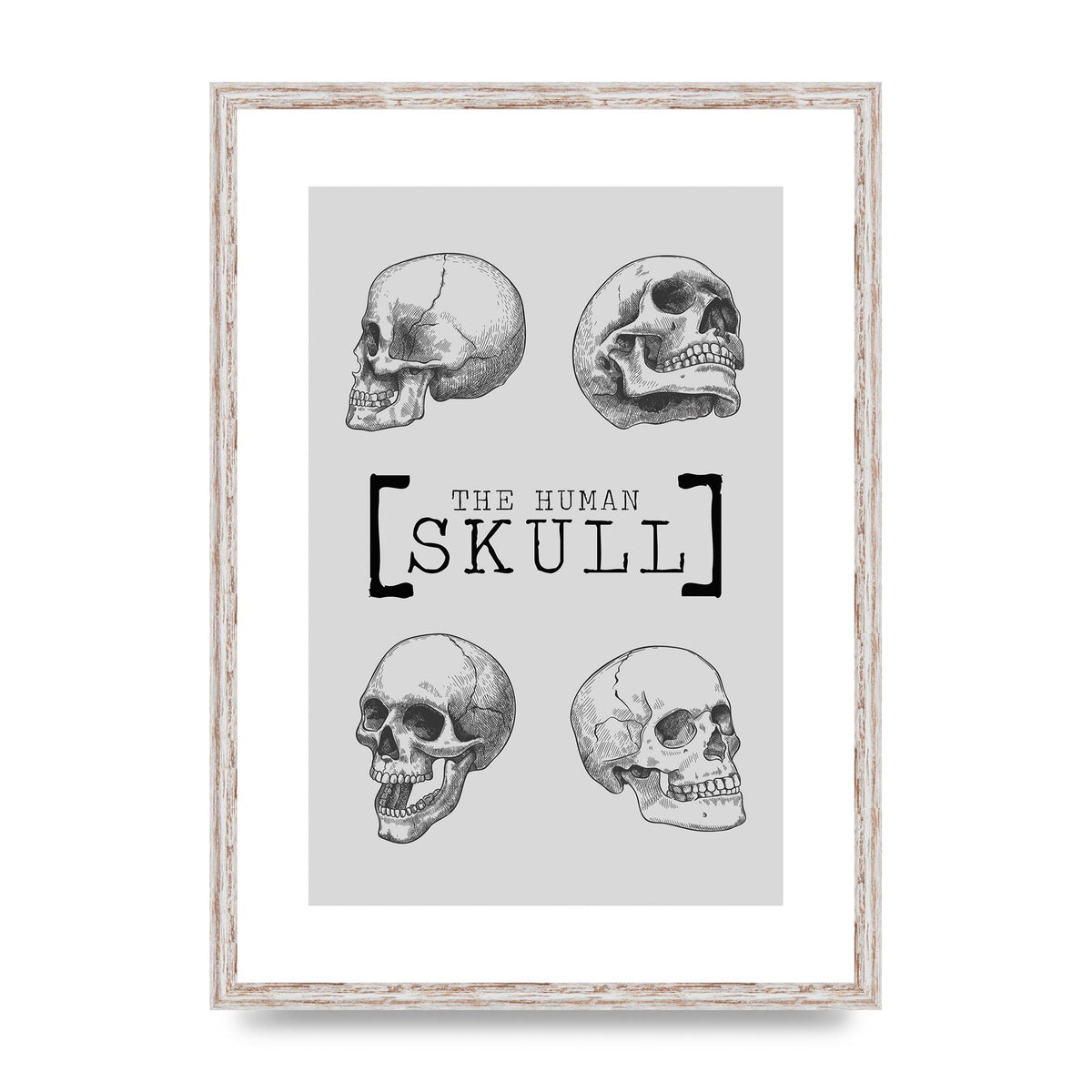 The Human Skull Printed Poster - A2 framed